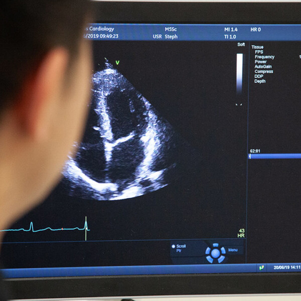 About us bulk billed cardiac testing