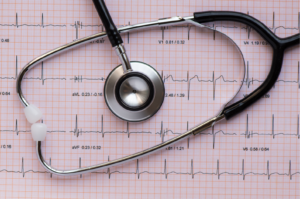 ecg report, example of a report generated by our bulk billed ecg testing